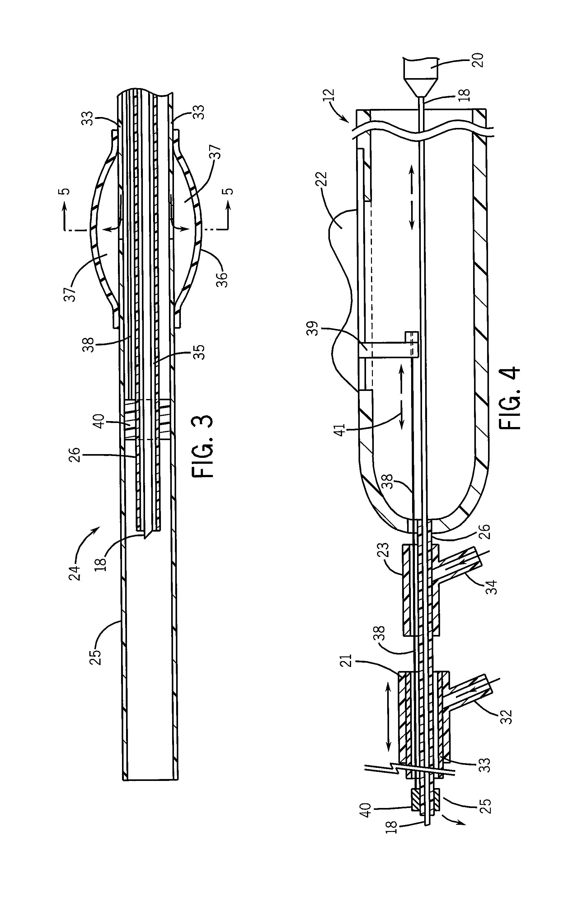 Steerable sonohysterographic injection catheter for uterine cancer sentinel lymph node mapping