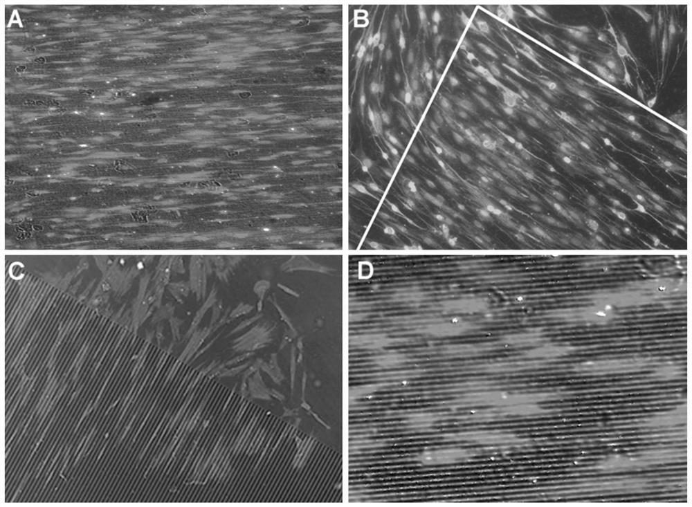 A kind of tissue engineered nerve graft and its preparation method