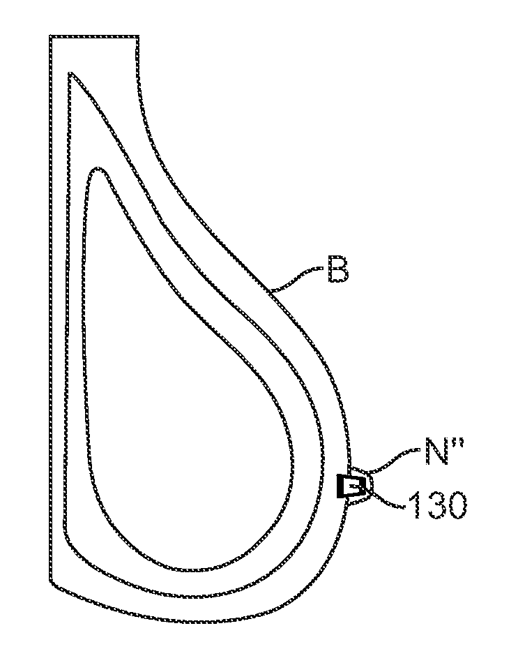 Apparatus and methods for nipple and breast formation