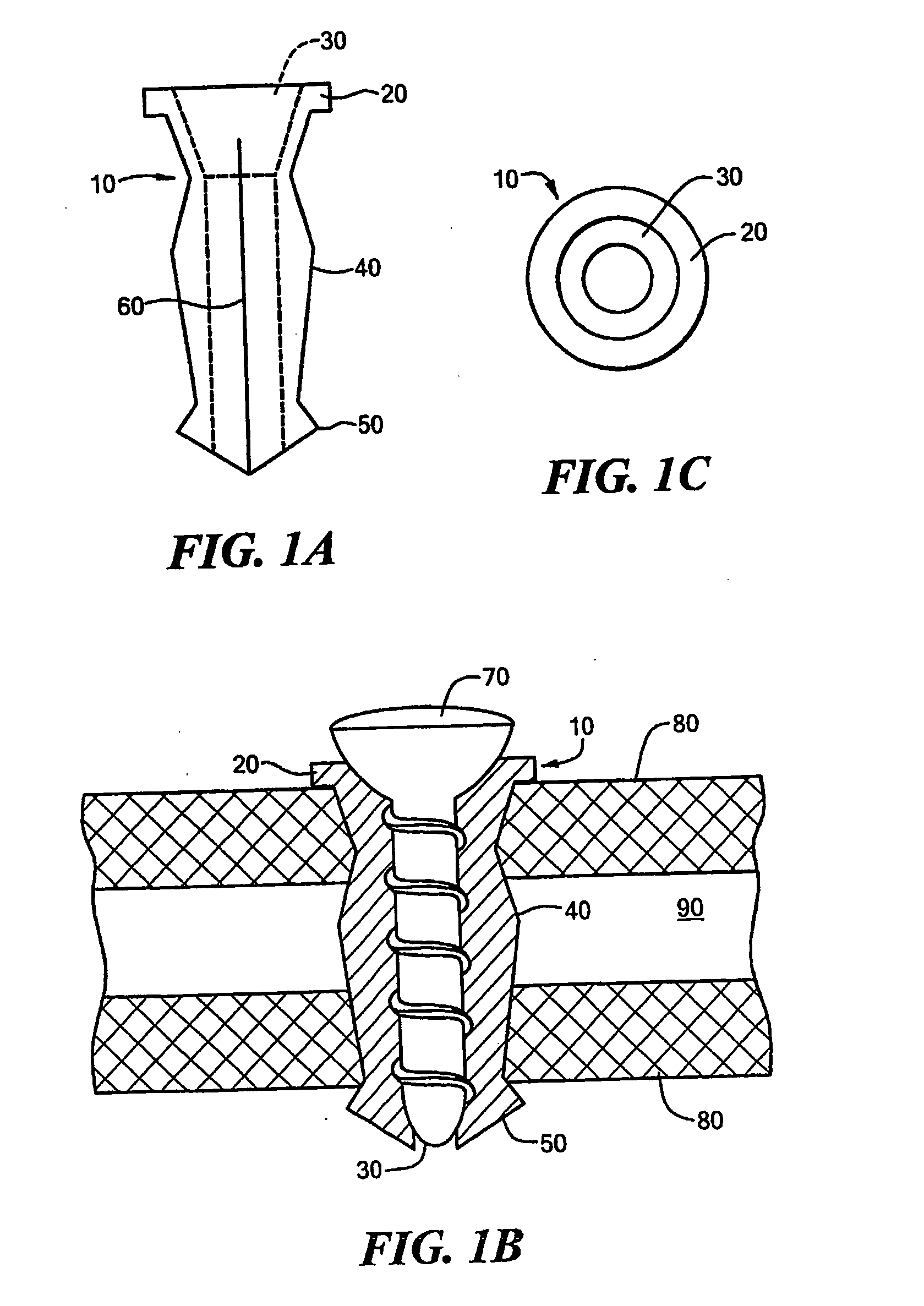 Fixation augmentation device and related techniques