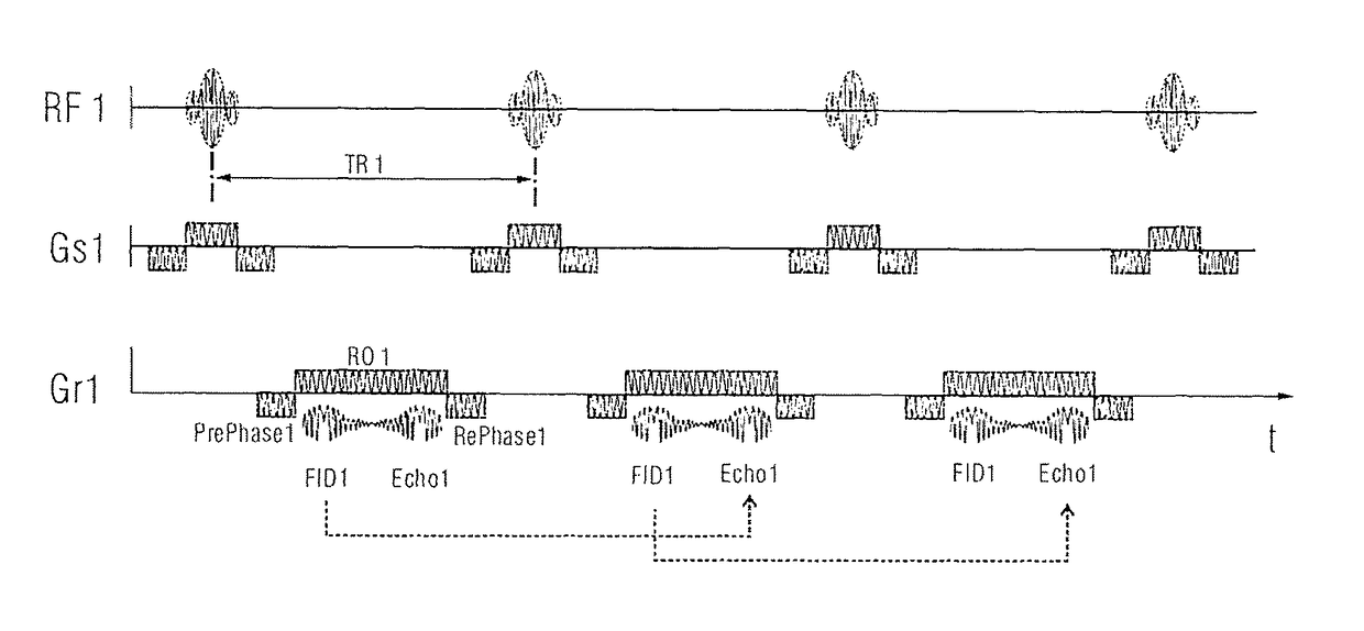 Magnetic resonance imaging method and apparatus