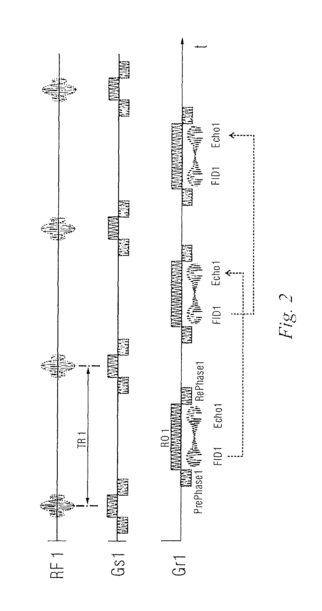 Magnetic resonance imaging method and apparatus