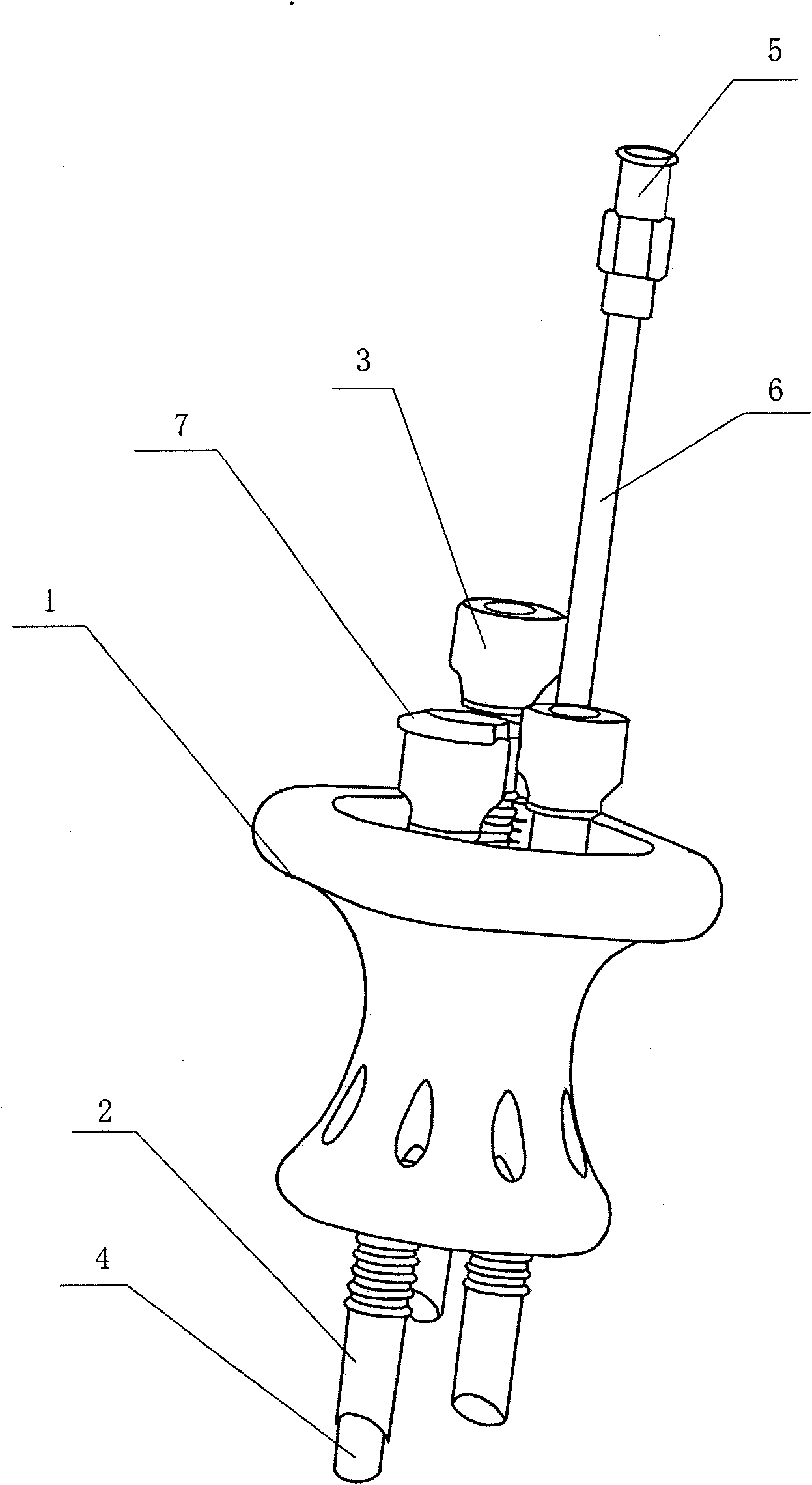 Bracket for single-incision abdominal cavity operation