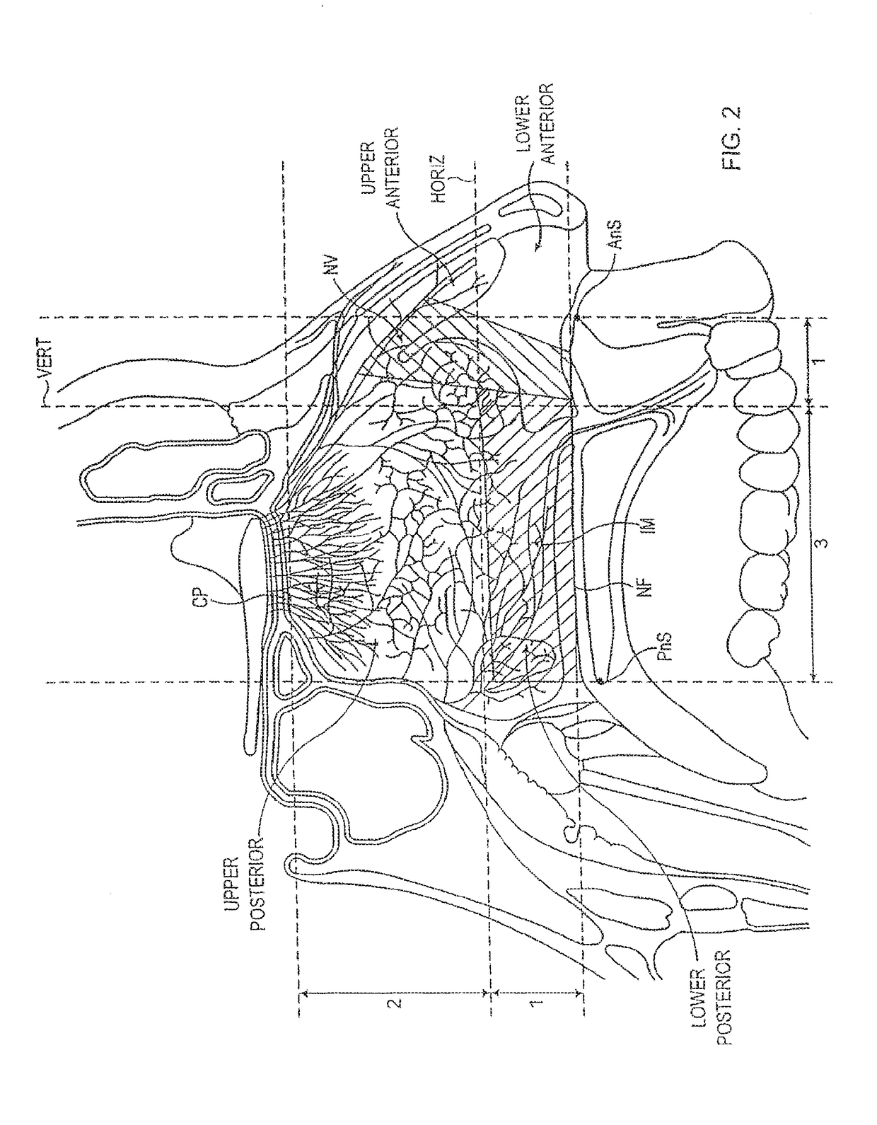 Nasal delivery