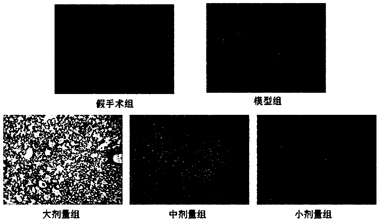 Application of basil polysaccharide extract in preparation of medicine for treating pulmonary fibrosis