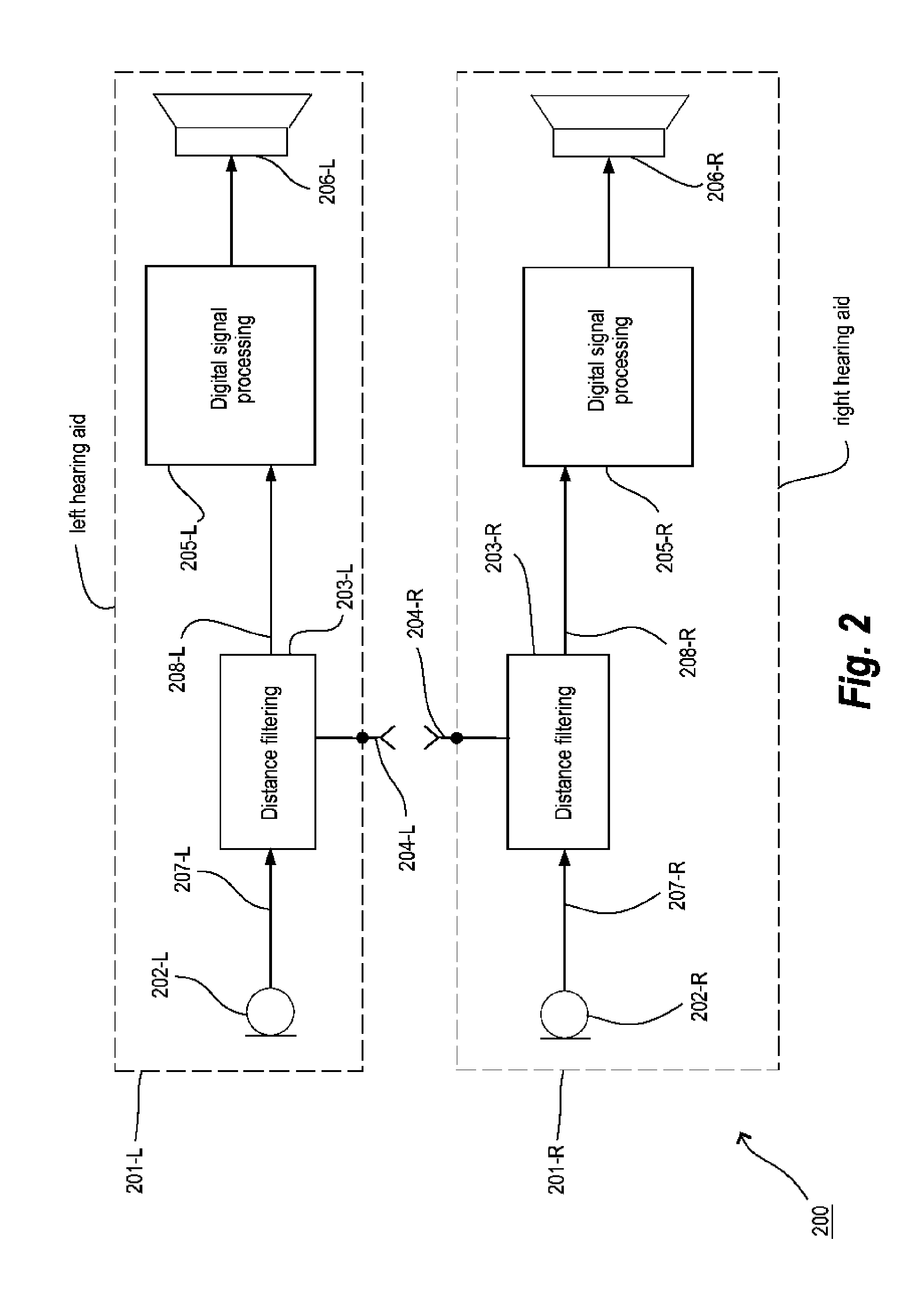 Method of signal processing in a hearing aid system and a hearing aid system