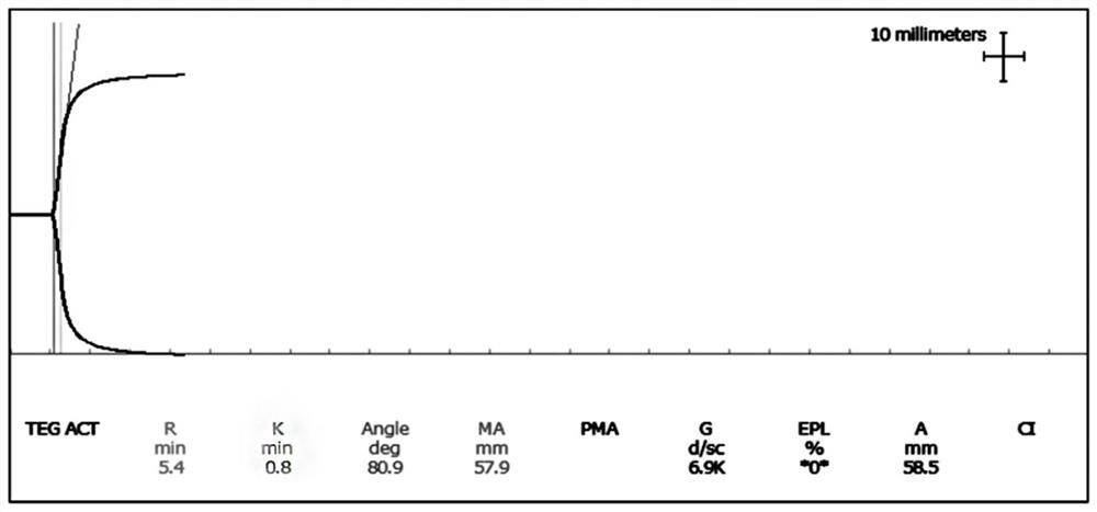 Multi-level quality control product and preparation method thereof, and application of multi-level quality control product in thrombelastogram detection