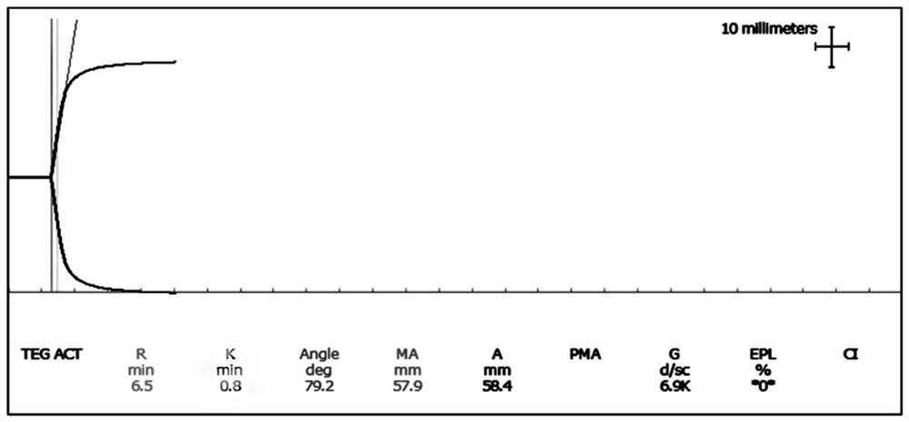 Multi-level quality control product and preparation method thereof, and application of multi-level quality control product in thrombelastogram detection