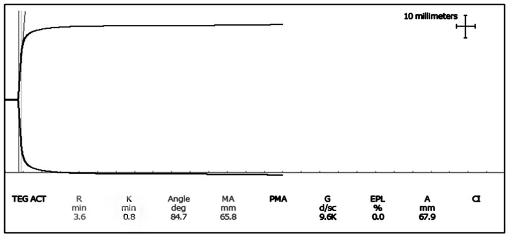 Multi-level quality control product and preparation method thereof, and application of multi-level quality control product in thrombelastogram detection