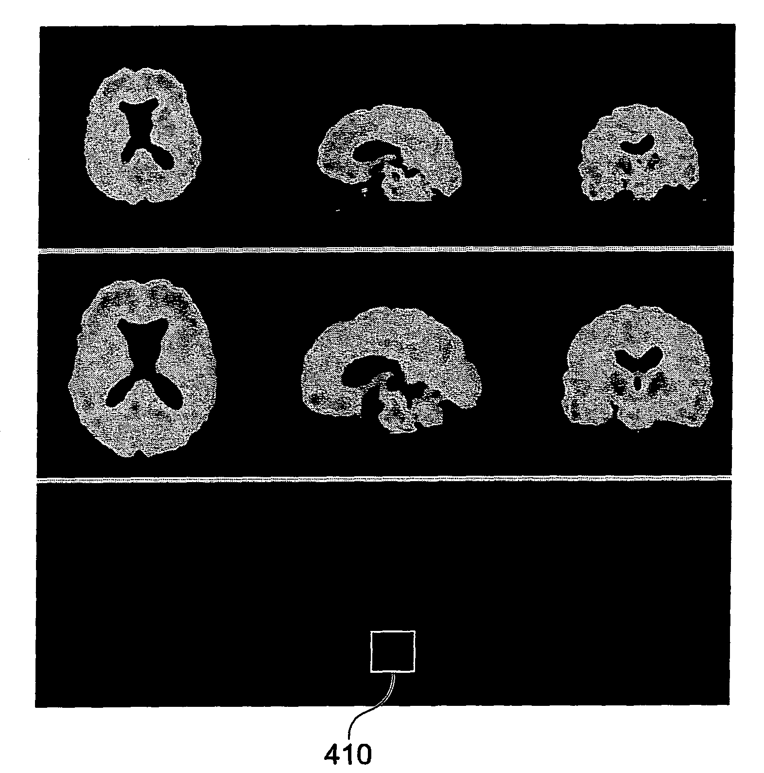 Tools for aiding in the diagnosis of neurodegenerative diseases