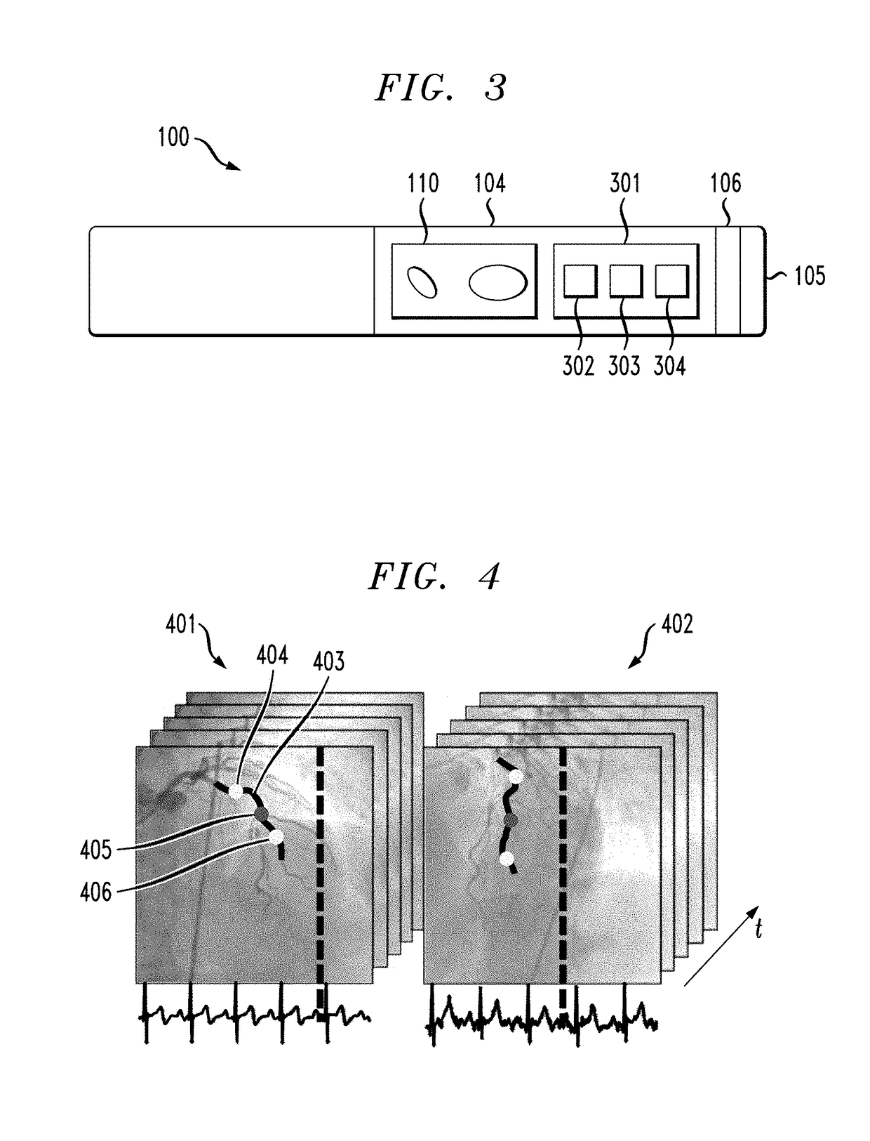 Intravascular catheter including markers