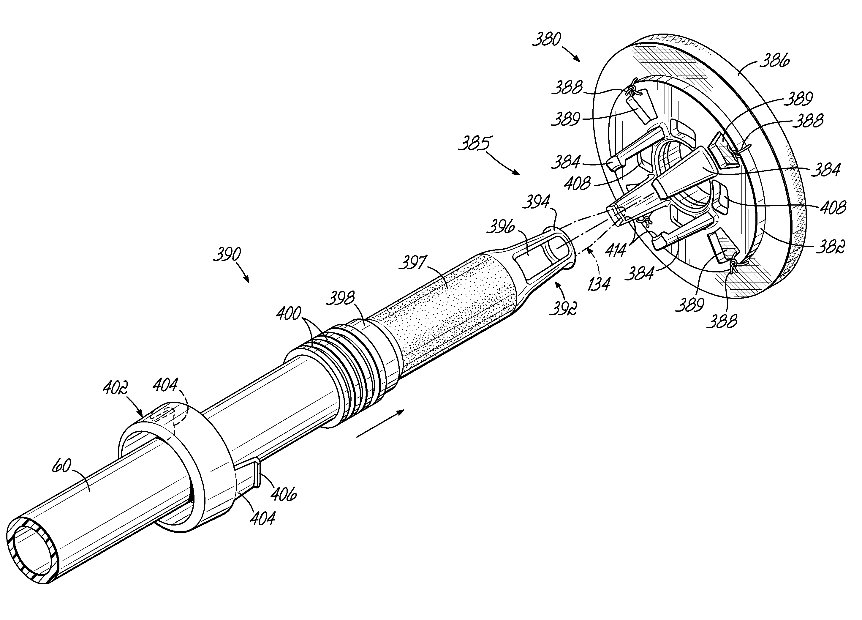 Cannula tips, tissue attachment rings, and methods of delivering and using the same