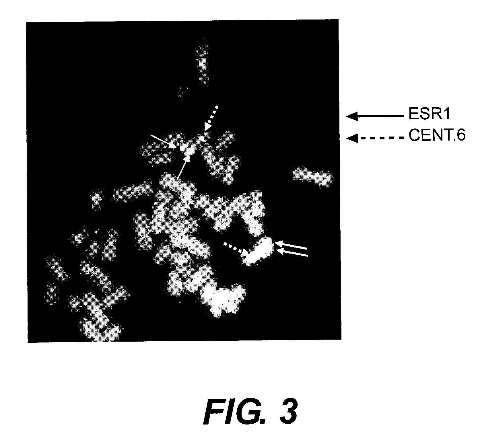 Methods for utilizing esr copy number changes in breast cancer treatments and prognoses