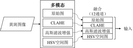 Recognition and detection method, device and equipment for macular area of ​​fundus image