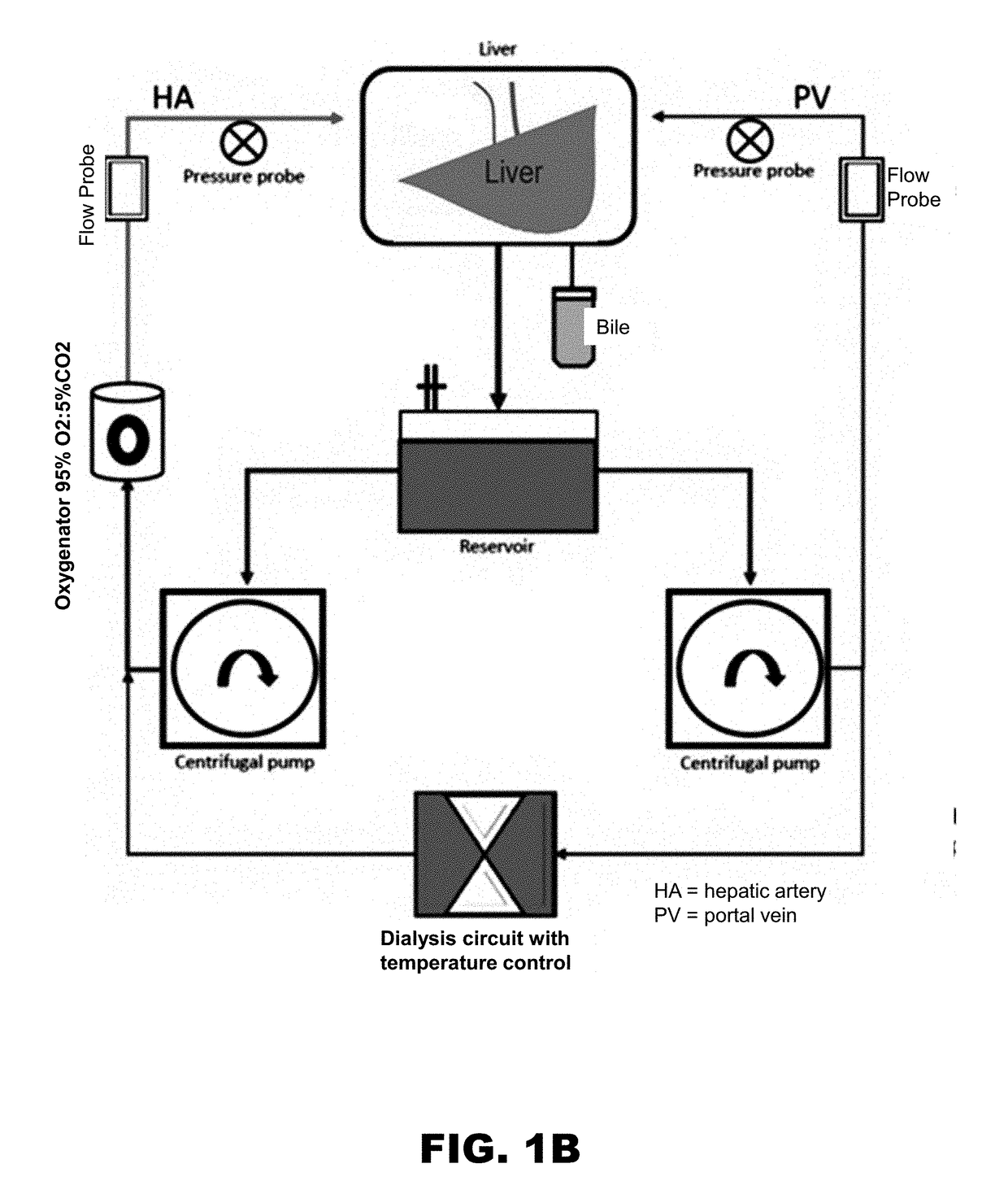 Systems and methods for normothermic extracorporeal organ perfusion