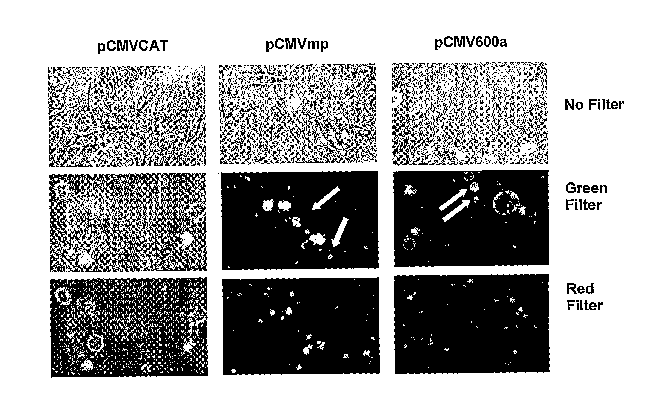 Adipocyte-specific constructs and methods for inhibiting platelet-type 12 lipoxygenase expression