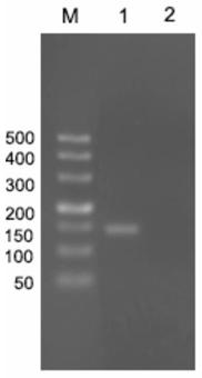 A primer, kit and detection method for detecting epidemic hematopoietic organ necrosis virus using pyrosequencing technology