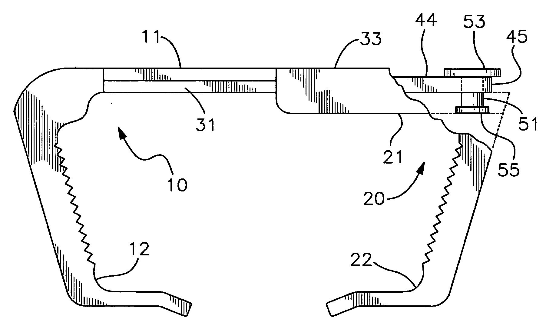 Lock and release mechanism for a sternal clamp