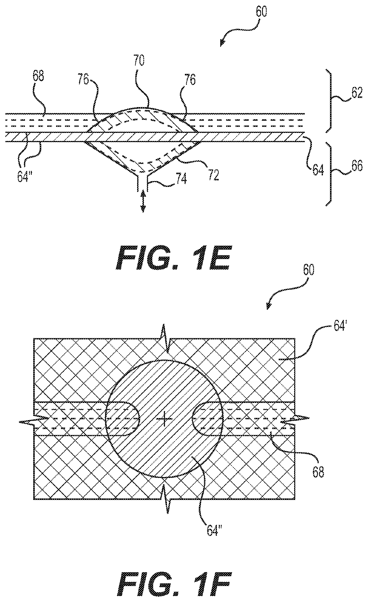 Pumps and hardware for organ-on-chip platforms