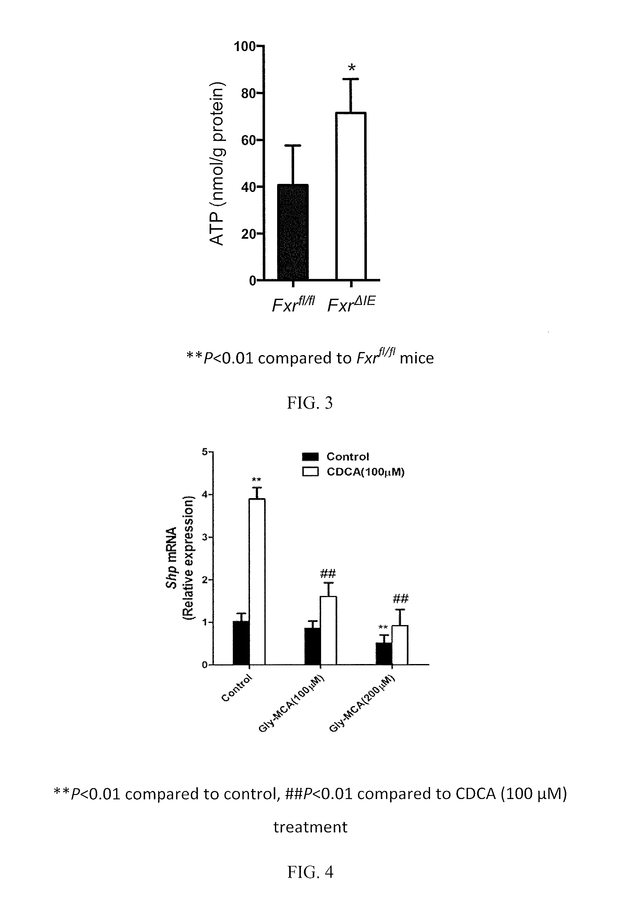 Inhibitors of the farnesoid X receptor and uses in medicine