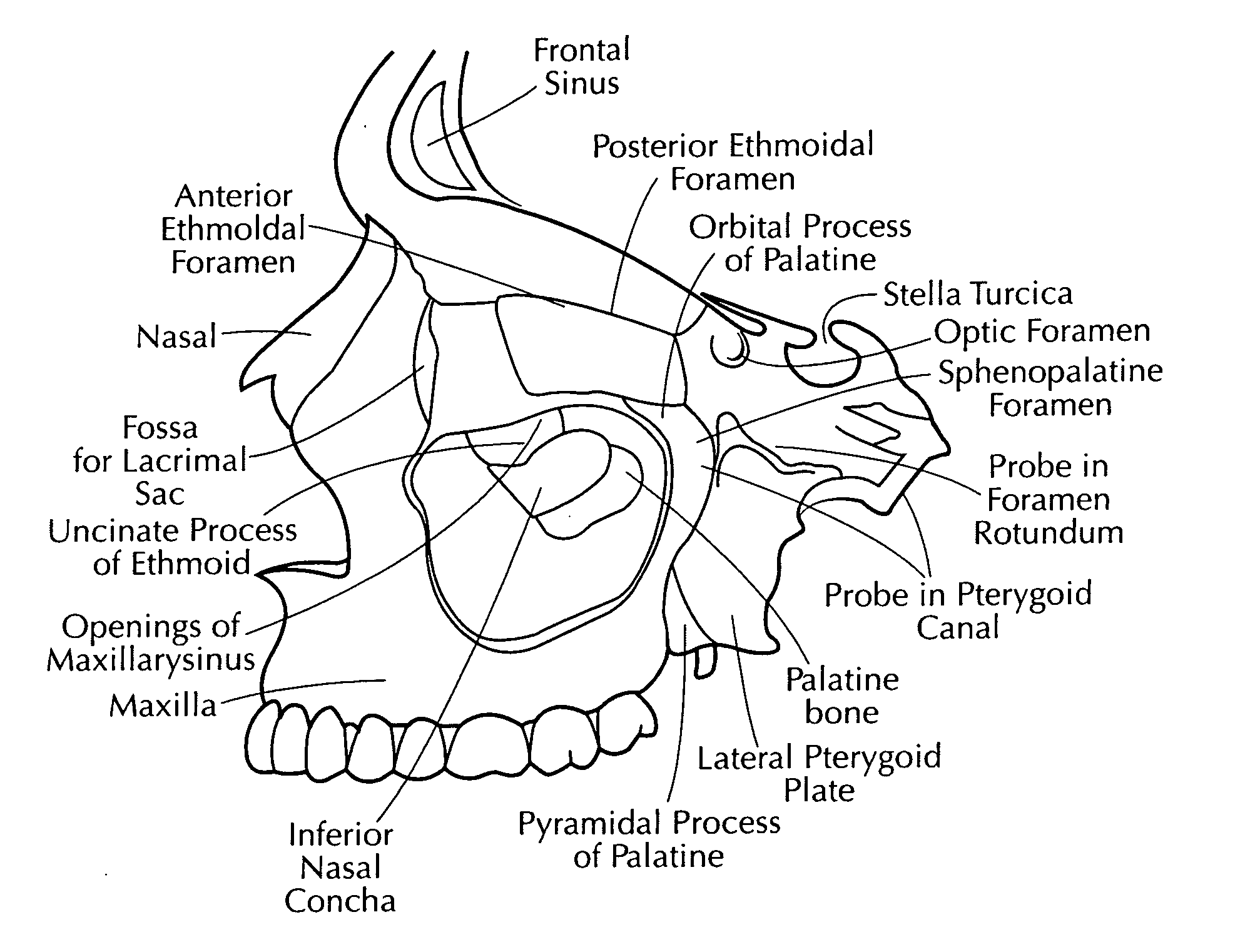 Training aid for a dental injection