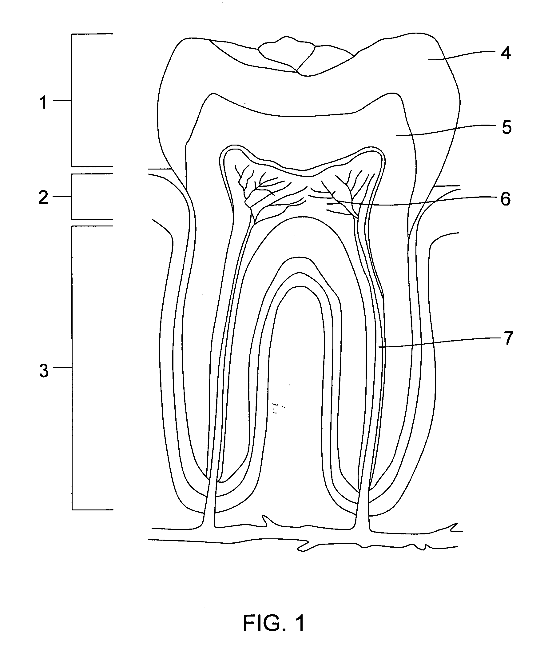 Enhanced Medical Implant