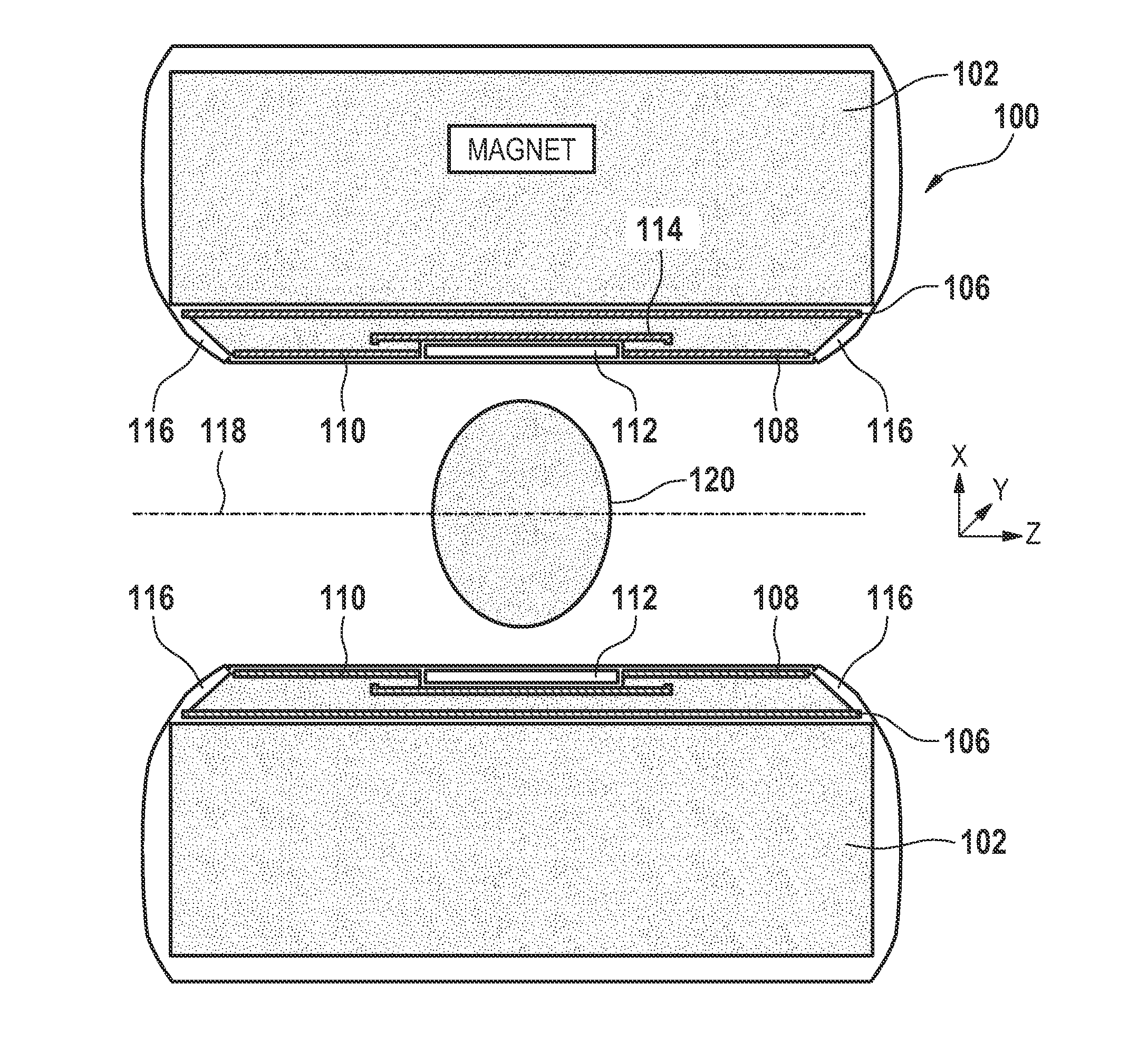 Magnetic resonance imaging system with satellite gradient coils