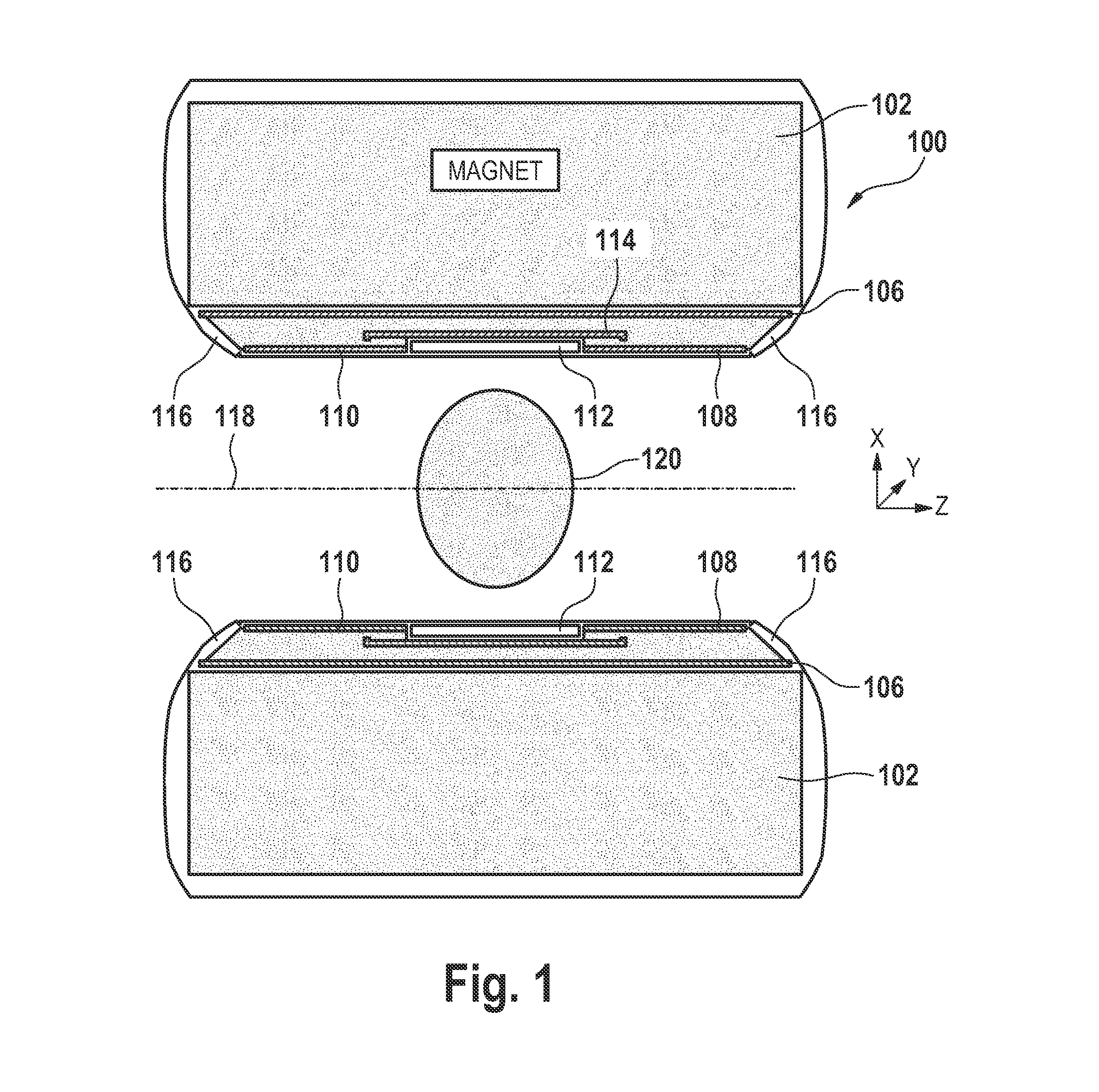 Magnetic resonance imaging system with satellite gradient coils