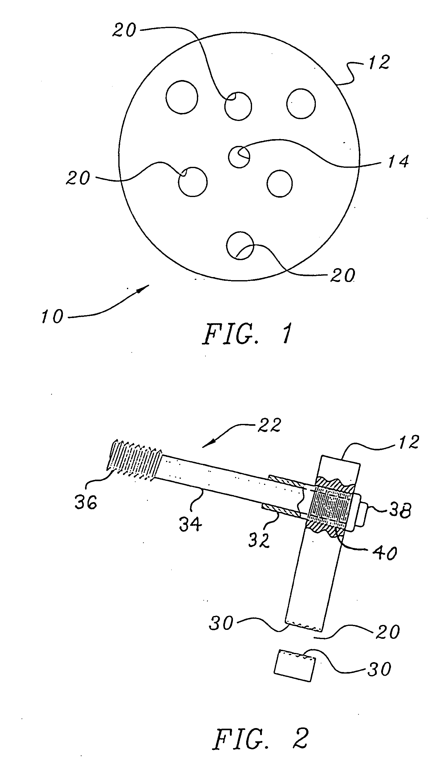 Bone end (Epiphysis) fracture fixation device and method of use