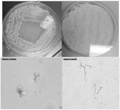 PKS type-I polyketones compound with immunosuppression activity and preparation method and application of PKS type-I polyketones compound