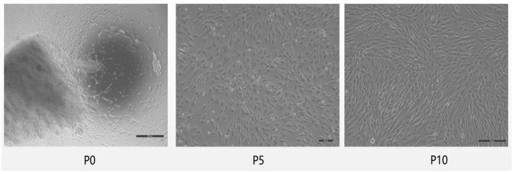 Culture method of mesenchymal stem cells