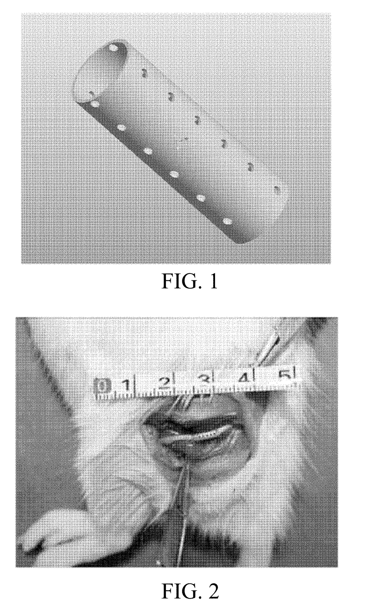 Biodegradable magnesium alloy nerve conduit for nerve defect repair and its preparation method