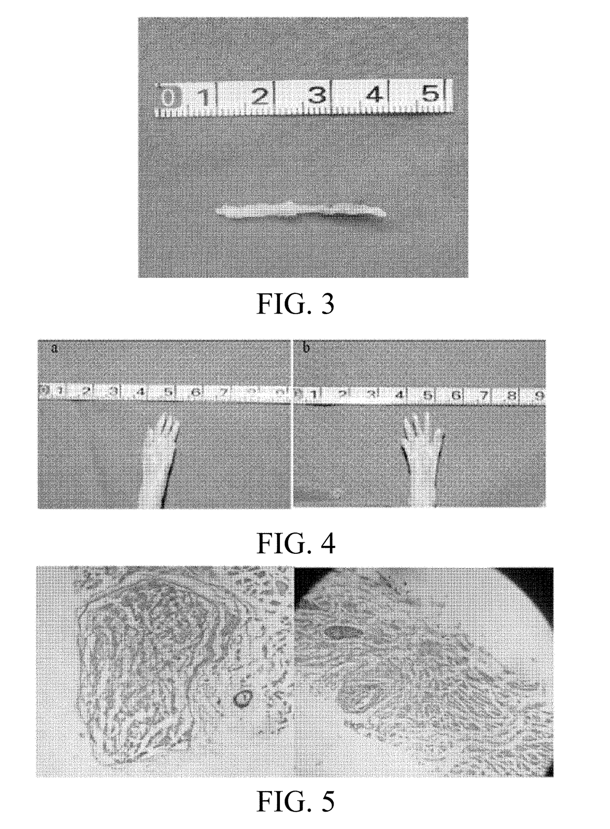 Biodegradable magnesium alloy nerve conduit for nerve defect repair and its preparation method