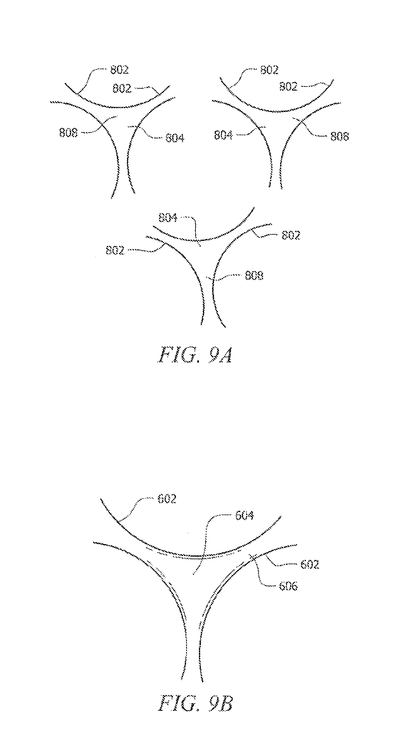 Porous implant structures