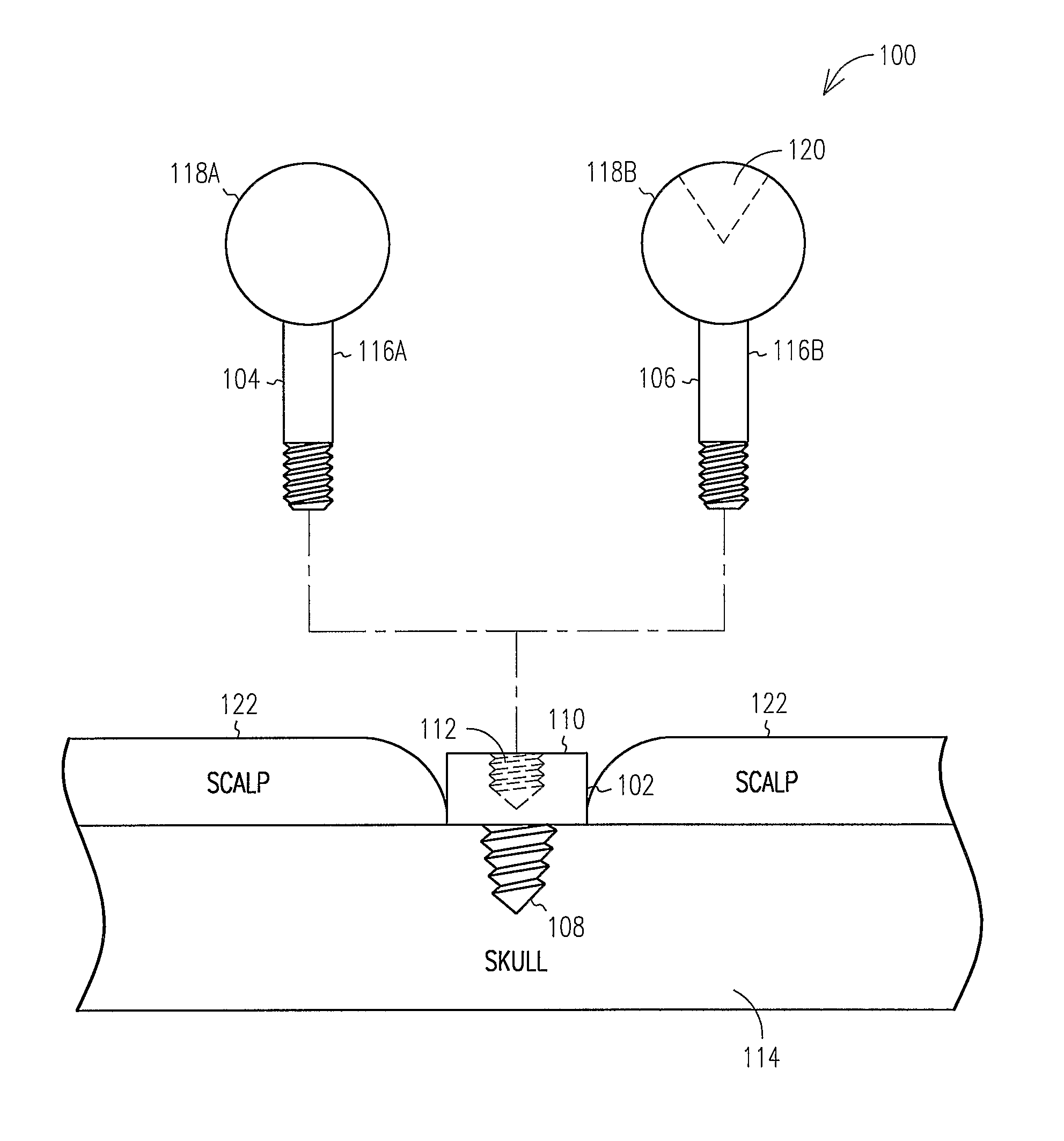 Fiducial marker and protective cap