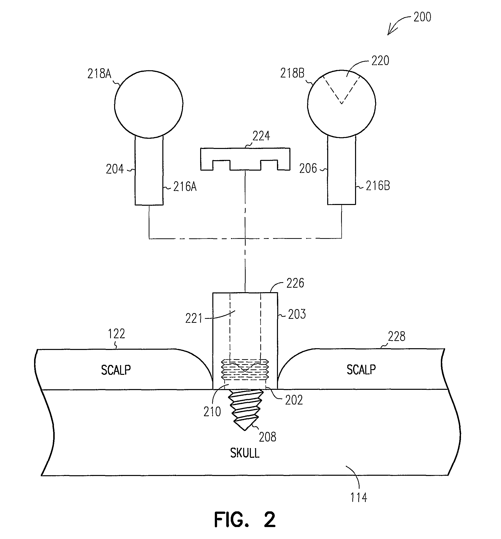 Fiducial marker and protective cap