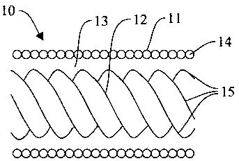 A push device and interventional delivery system