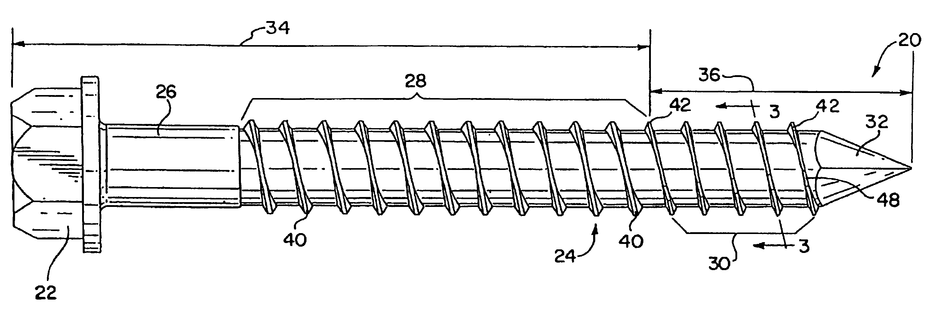 Masonry anchor device