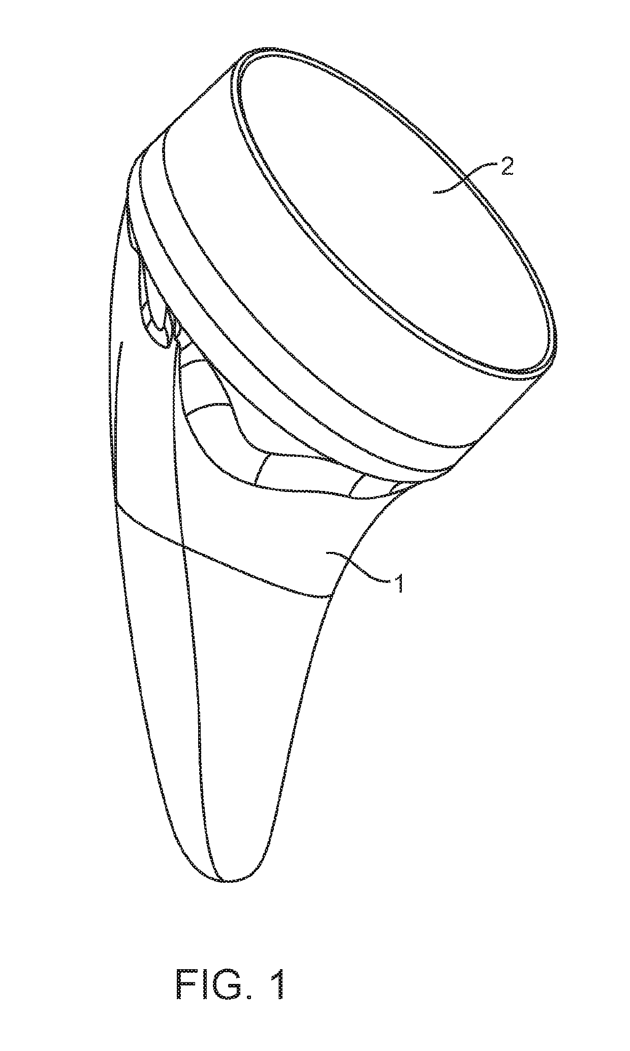 Shoulder arthroplasty implant system