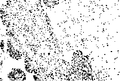 Preparation of monoclonal antibody for mouse anti-human type BRAF V600E mutant protein and immunohistochemical application of monoclonal antibody