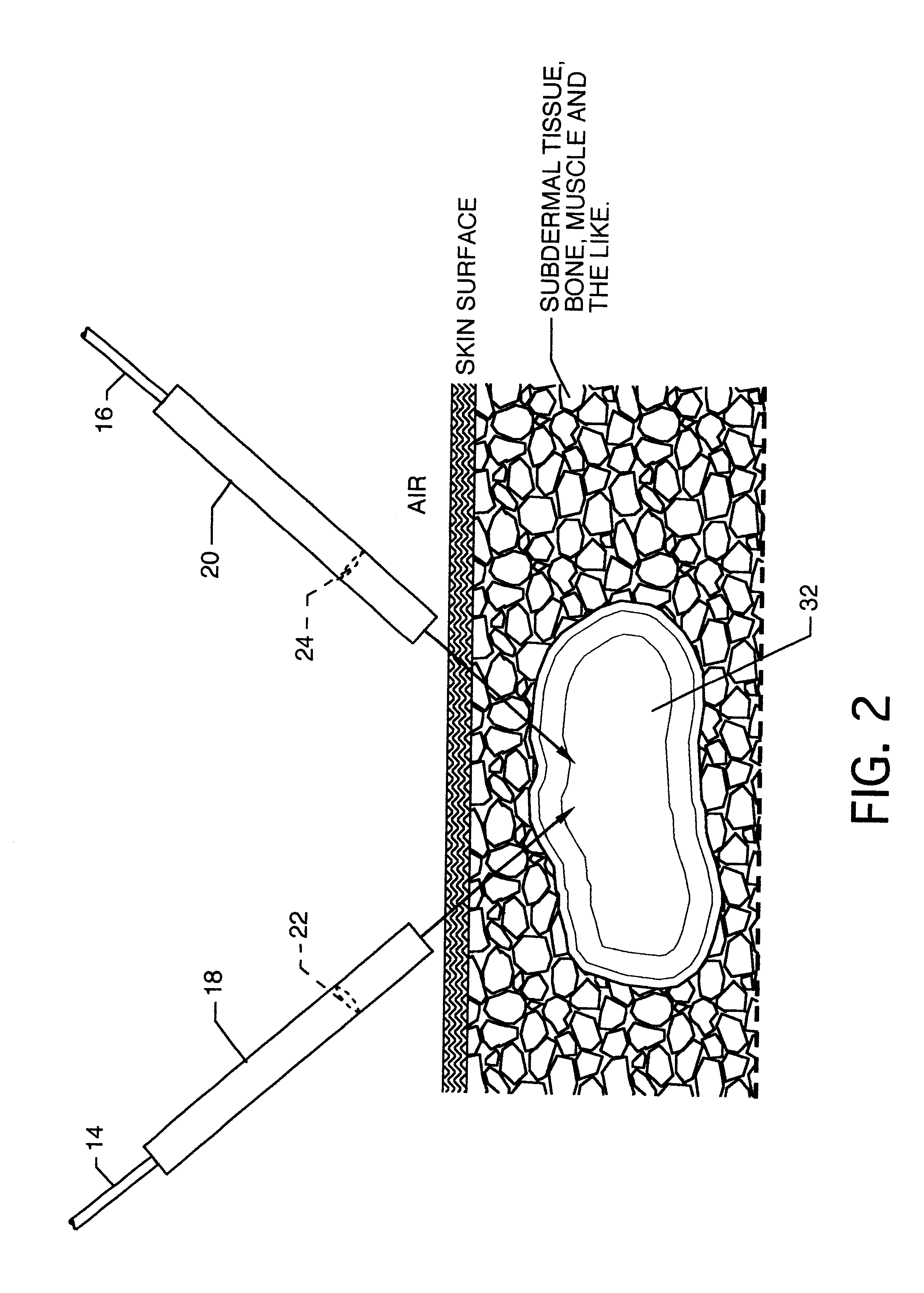 Violation of time reversal invariance in living tissue