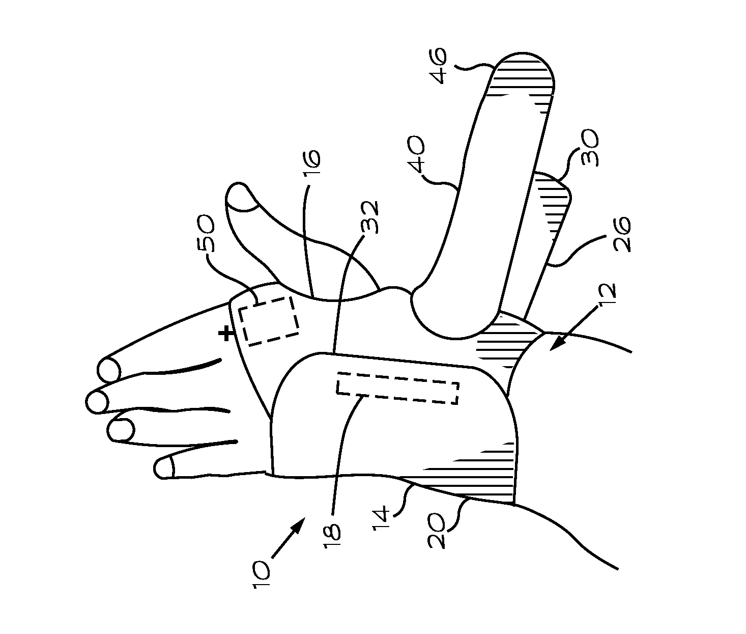 Ulnar Sided Wrist Support Brace