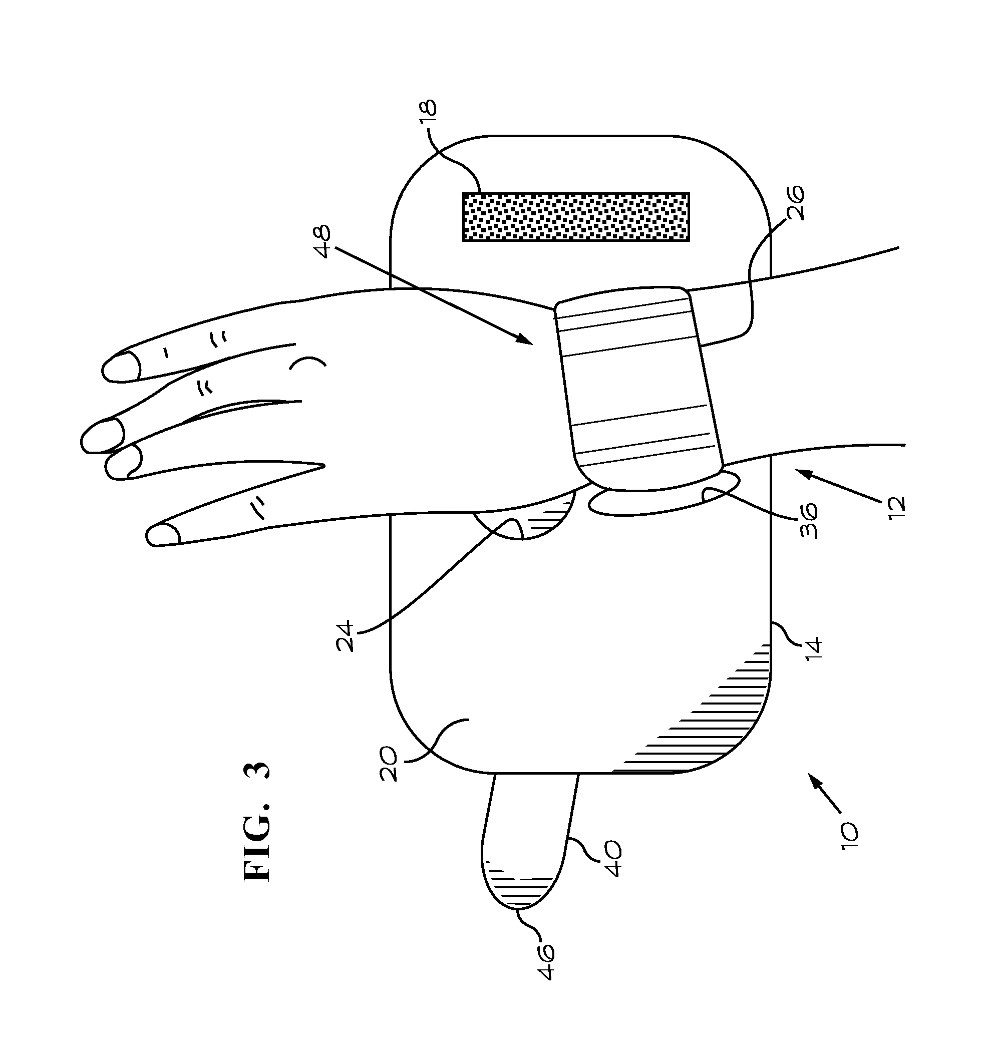 Ulnar Sided Wrist Support Brace