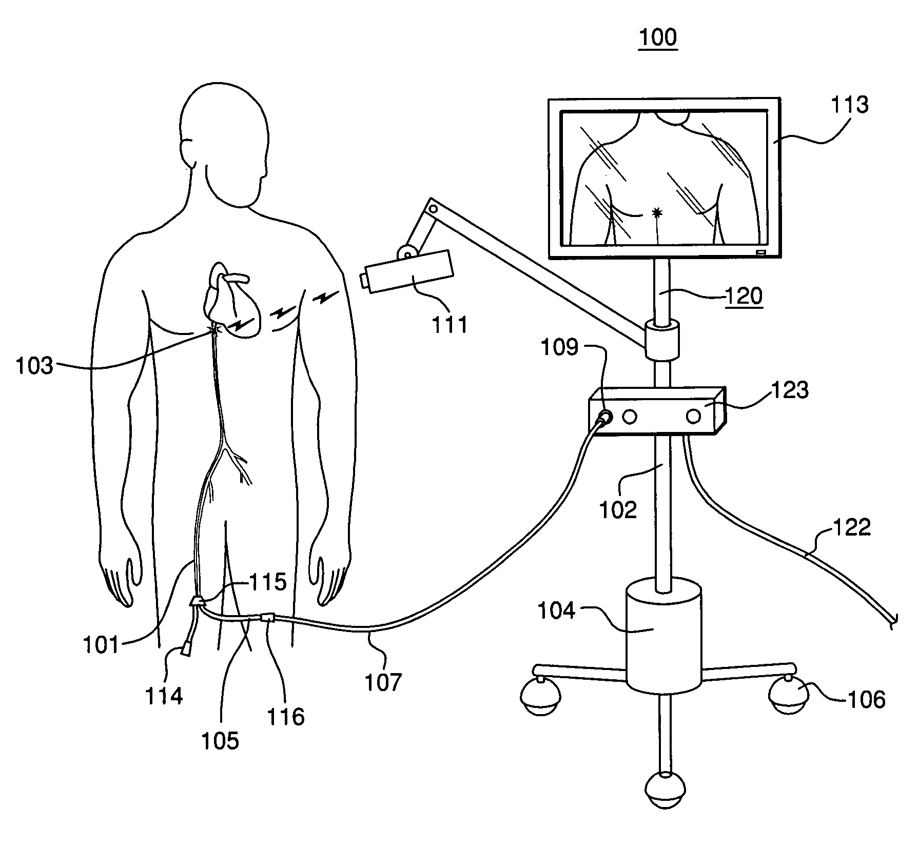 Optically guided system for precise placement of a medical catheter in a patient