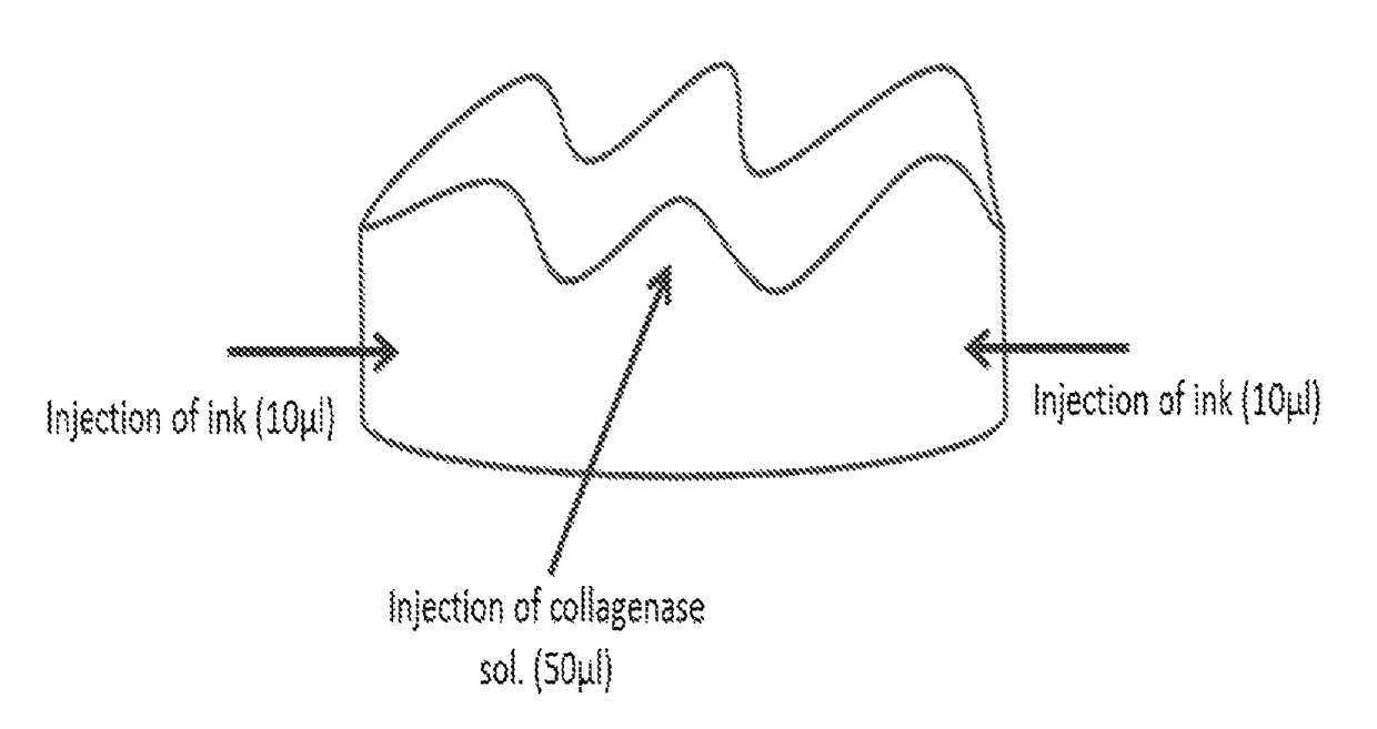 Methods for extracting a tooth