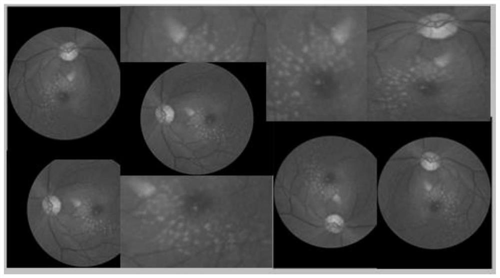 Focus image classification and identification method based on fundus image