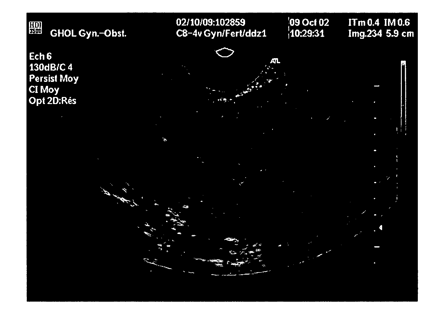 Medium for contrast enhancement or convenience for ultrasonic, endoscopic, and other medical examinations