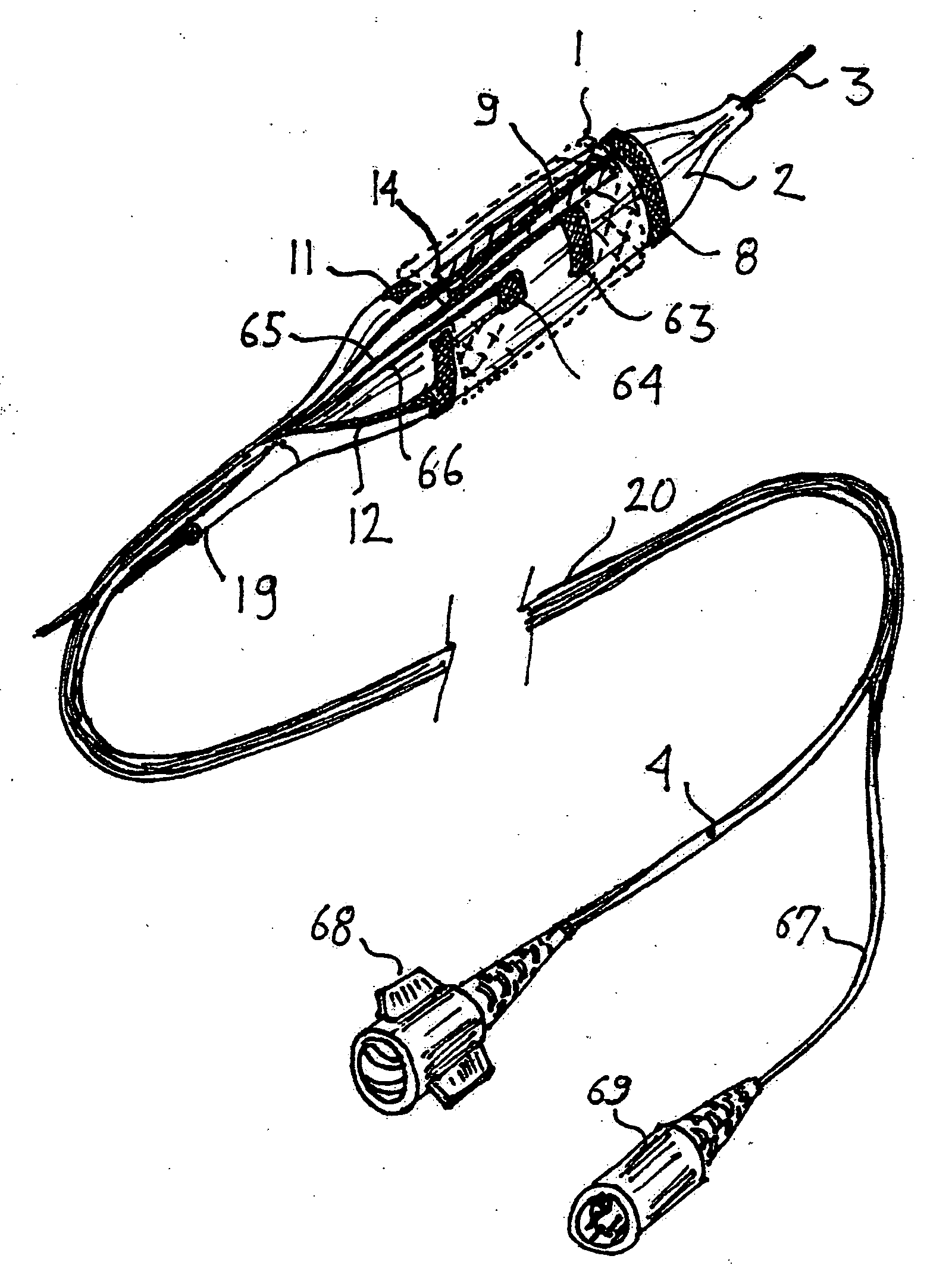 Lumen diameter and stent apposition sensing