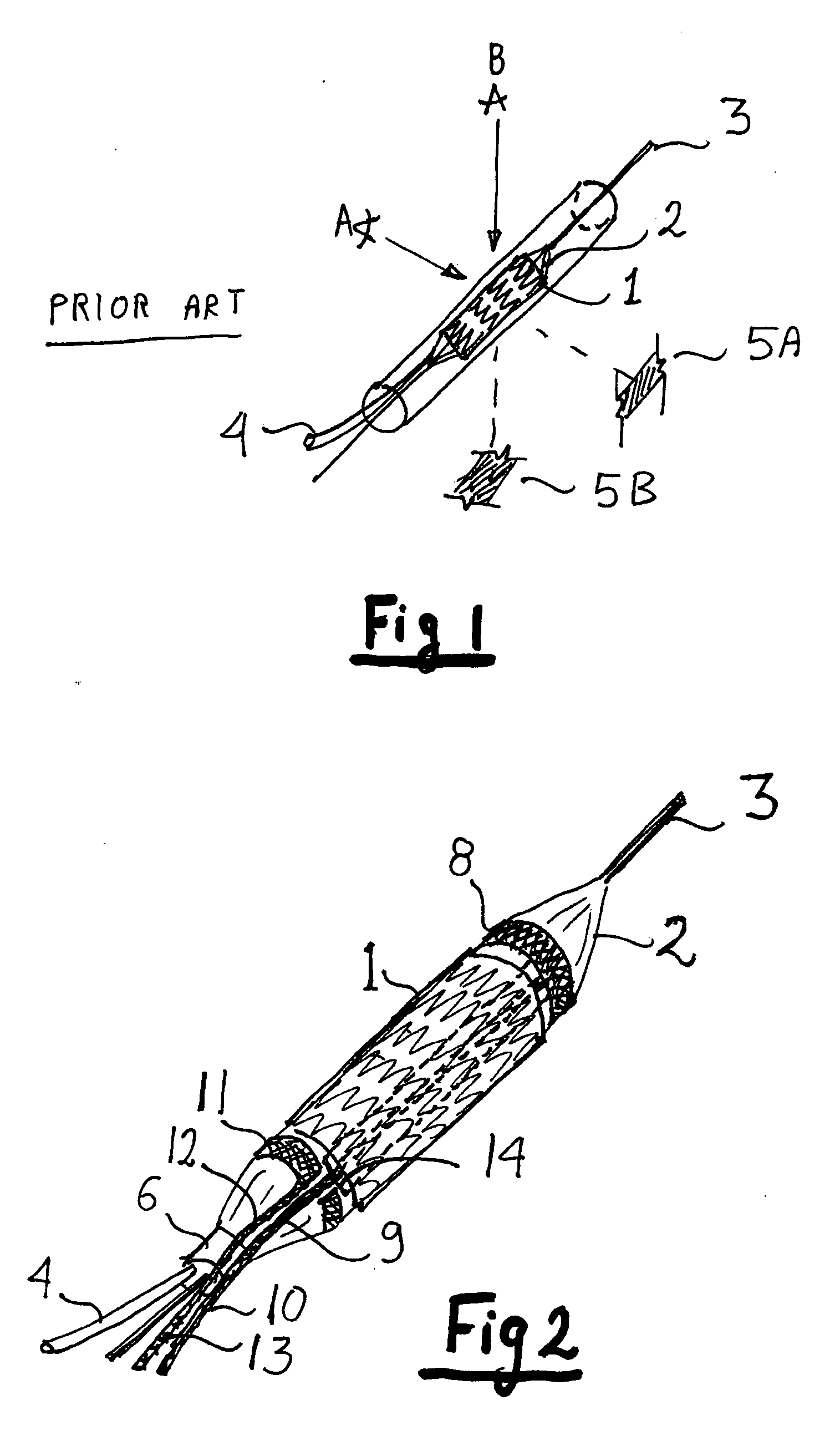 Lumen diameter and stent apposition sensing