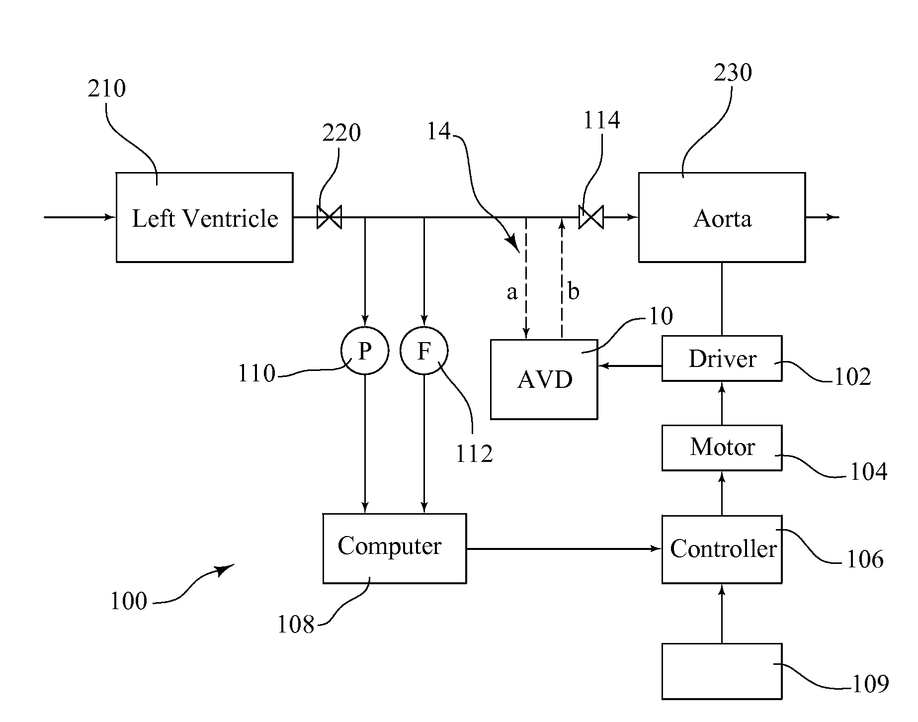 System and method for providing cardiac support and promoting myocardial recovery